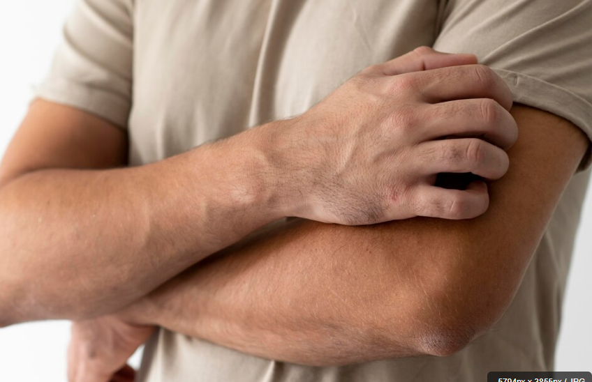 대상포진과 백신 부작용